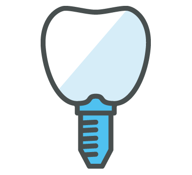 インプラント入れ歯